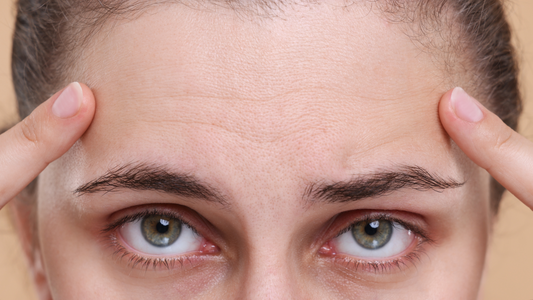 Dehydration Lines vs. Wrinkles: What's the Difference?